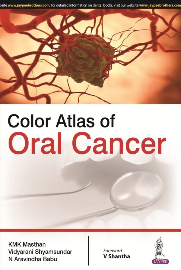 Color Atlas of Oral Cancer Hardcover – 1 January 2016 by Masthan K.M.K (Author)